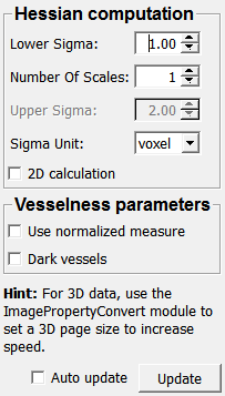 ../../../Modules/ML/MLGaussFiltersStable/mhelp/Images/Screenshots/Vesselness._default.png