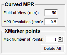 ../../../Modules/Macros/CurvedMPR/mhelp/Images/Screenshots/CurvedMPR._default.png