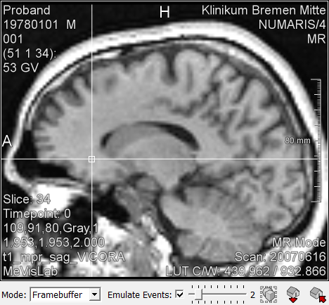 ../../../Modules/Macros/Viewers/mhelp/Images/Screenshots/SimulatedHighDPIViewer.Viewer.png