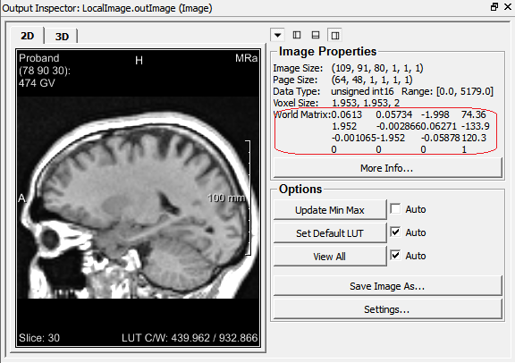 Image Properties for a Sagittal Image