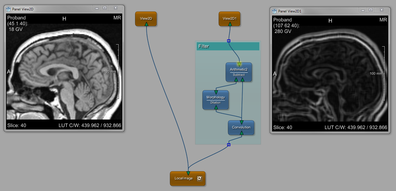 Resulting Contour Filter Network