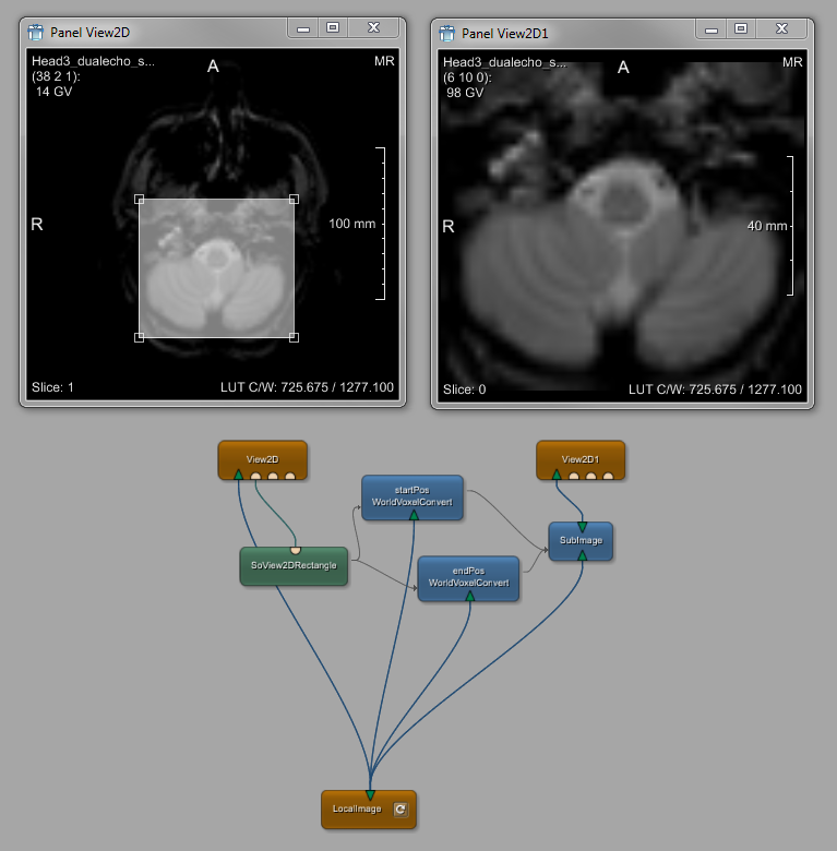 Example Network ROI Selection