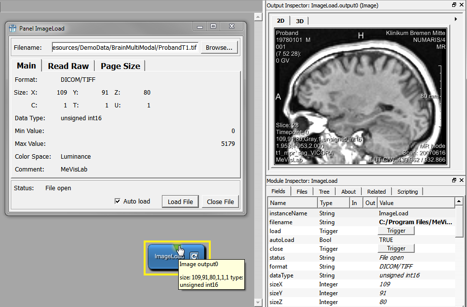 ImageLoad Panel and Output Inspector