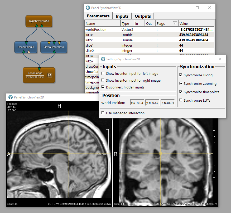 Example Network for SynchroView2D with Viewer (Panel), Automatic Panel, and Settings