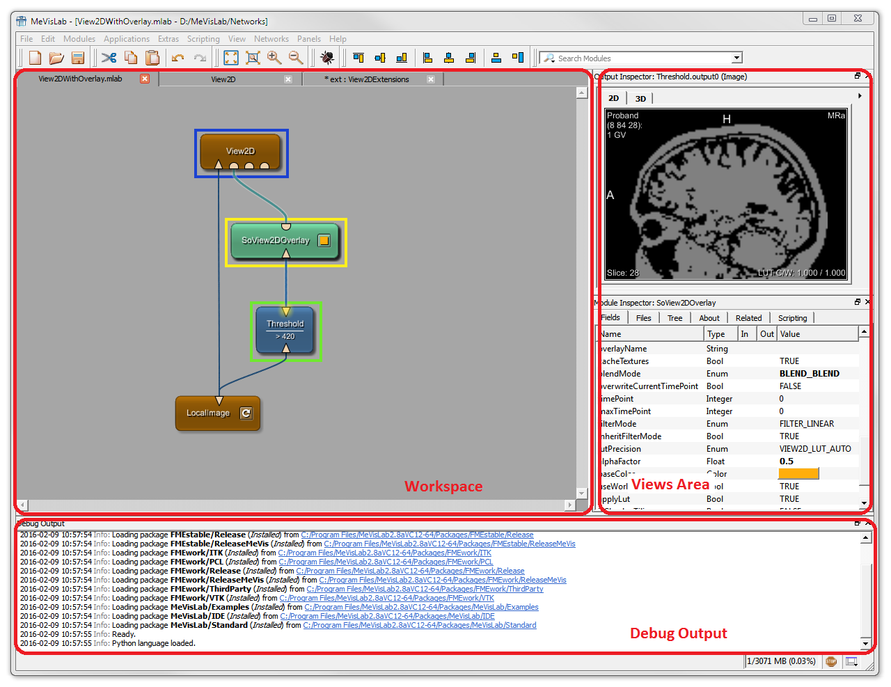 Typical MeVisLab User Interface