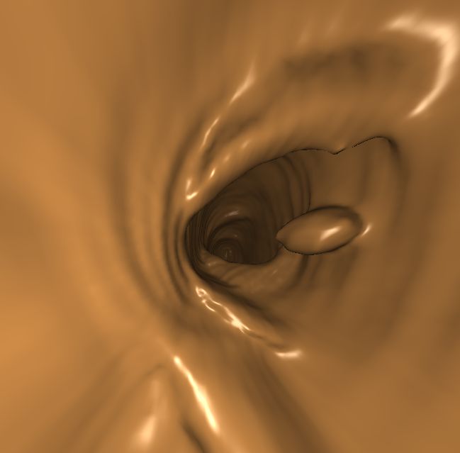 ../../../Modules/Inventor/SoGVR/mhelp/Images/EndoscopicFirstHit.jpg