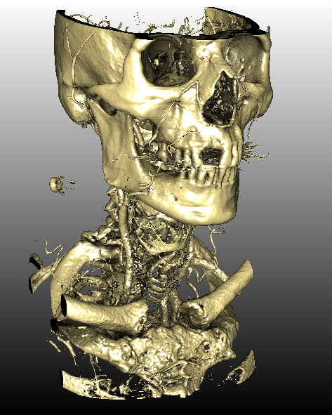 ../../../Modules/Inventor/SoGVR/mhelp/Images/FirstHitWithAmbientOcclusion.png