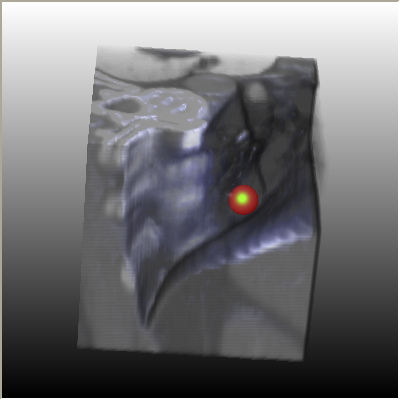 ../../../Modules/Inventor/SoGVR/mhelp/Images/PointLightLinearQuadraticAttenuation.png