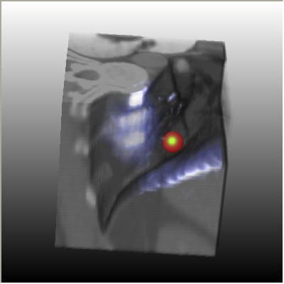../../../Modules/Inventor/SoGVR/mhelp/Images/PointLightSpericalAttenuation.png