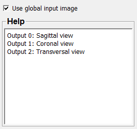../../../Modules/ML/MLCoordUtils1/mhelp/Images/Screenshots/OrthoReformat3._default.png