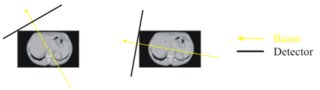 ../../../Modules/ML/MLDRR/mhelp/Images/snapangle01.gif
