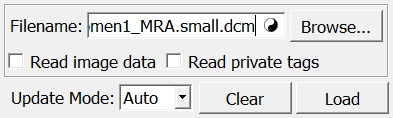 ../../../Modules/ML/MLDicomTreeModules/mhelp/Images/Screenshots/LoadDicomTree._default.png