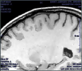 ../../../Modules/ML/MLFilter1/mhelp/Images/DiffusionExampleWall9.jpg