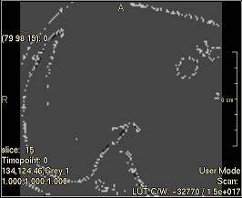 ../../../Modules/ML/MLFilter2/mhelp/Images/TextureFilterImages/Busyness(Ngtdm).jpg