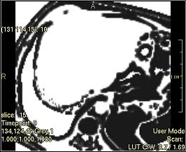 ../../../Modules/ML/MLFilter2/mhelp/Images/TextureFilterImages/Coarseness(Ngtdm).jpg