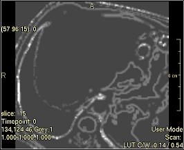 ../../../Modules/ML/MLFilter2/mhelp/Images/TextureFilterImages/Contrast(Ngtdm).jpg