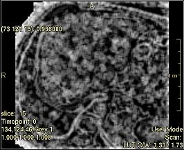 ../../../Modules/ML/MLFilter2/mhelp/Images/TextureFilterImages/Entropie(Ngldm).jpg