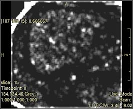 ../../../Modules/ML/MLFilter2/mhelp/Images/TextureFilterImages/LargeNumberEmphasis(Ngldm).jpg