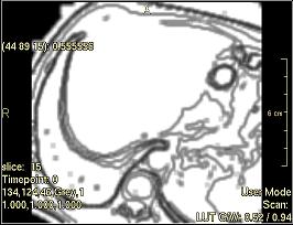 ../../../Modules/ML/MLFilter2/mhelp/Images/TextureFilterImages/NumberNonuniformity(Ngldm).jpg