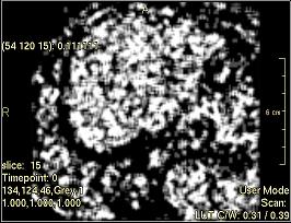../../../Modules/ML/MLFilter2/mhelp/Images/TextureFilterImages/SmallNumberEmphasis(Ngldm).jpg