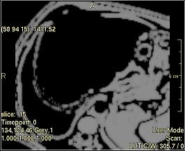 ../../../Modules/ML/MLFilter2/mhelp/Images/TextureFilterImages/TextureStrength(ngtdm).jpg