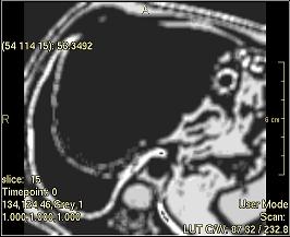 ../../../Modules/ML/MLFilter2/mhelp/Images/TextureFilterImages/complexity(ngtdm).jpg