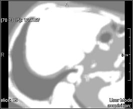 ../../../Modules/ML/MLFilter2/mhelp/Images/TextureFilterImages/contrast_matrix.jpg