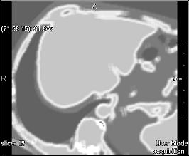 ../../../Modules/ML/MLFilter2/mhelp/Images/TextureFilterImages/correlation.jpg