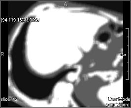 ../../../Modules/ML/MLFilter2/mhelp/Images/TextureFilterImages/diff_variance.jpg