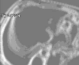 ../../../Modules/ML/MLFilter2/mhelp/Images/TextureFilterImages/runPercentage.jpg