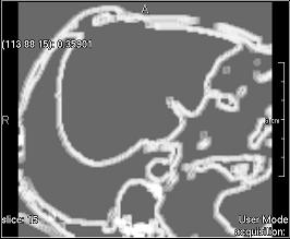 ../../../Modules/ML/MLFilter2/mhelp/Images/TextureFilterImages/sum_entropie.jpg