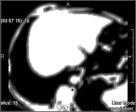 ../../../Modules/ML/MLFilter2/mhelp/Images/TextureFilterImages/sum_variance.jpg