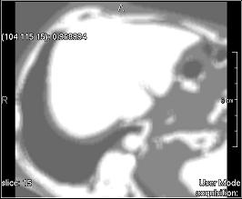 ../../../Modules/ML/MLFilter2/mhelp/Images/TextureFilterImages/variance.jpg