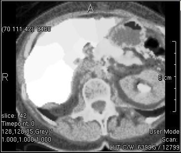 ../../../Modules/ML/MLFilter2/mhelp/Images/histo.png