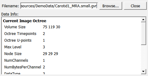 ../../../Modules/ML/MLGVR/mhelp/Images/Screenshots/GVRVolumeLoad._default.png