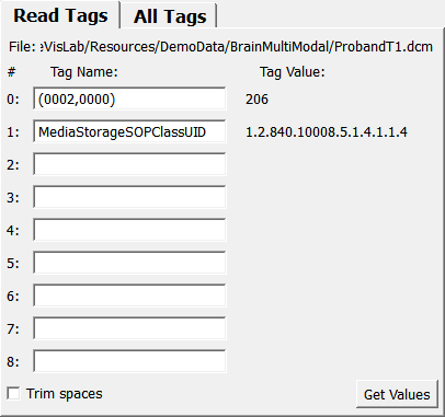 ../../../Modules/ML/MLImageFile/mhelp/Images/Screenshots/DicomTagViewer._default.png