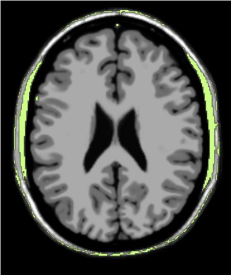 ../../../Modules/ML/MLJointHist/mhelp/Images/jointMask.JPG