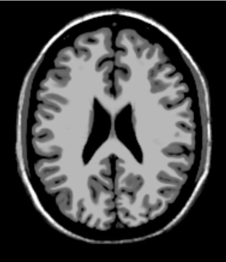 ../../../Modules/ML/MLJointHist/mhelp/Images/t1.JPG