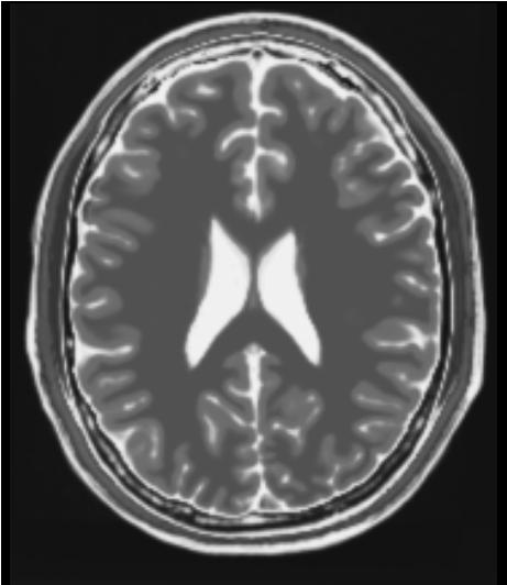 ../../../Modules/ML/MLJointHist/mhelp/Images/t2.JPG