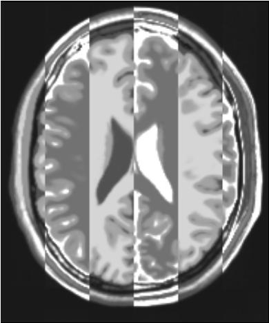 ../../../Modules/ML/MLJointHist/mhelp/Images/vertical.JPG