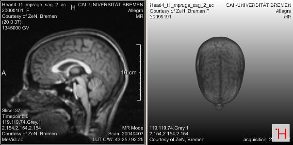 ../../../Modules/ML/MLRemoteRendering/mhelp/Images/Screenshots/RemoteRenderingCSOExampleModule._default.png