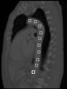 ../../../Modules/ML/MLResample1/mhelp/Images/MPRPath1.jpg