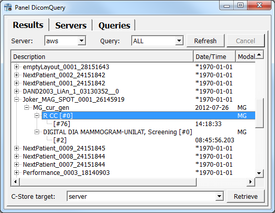 ../../../Modules/Macros/Dicom/mhelp/Images/DicomQueryResultTab.png