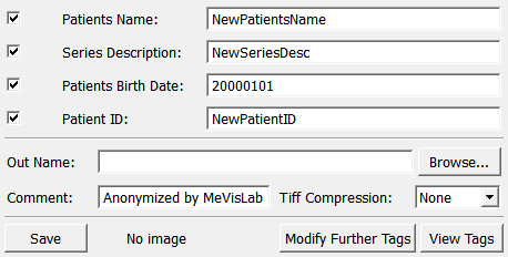 ../../../Modules/Macros/Dicom/mhelp/Images/Screenshots/AnonymizeMacro._default.png