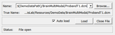 ../../../Modules/Macros/FileHandling/mhelp/Images/Screenshots/LocalImage._default.png