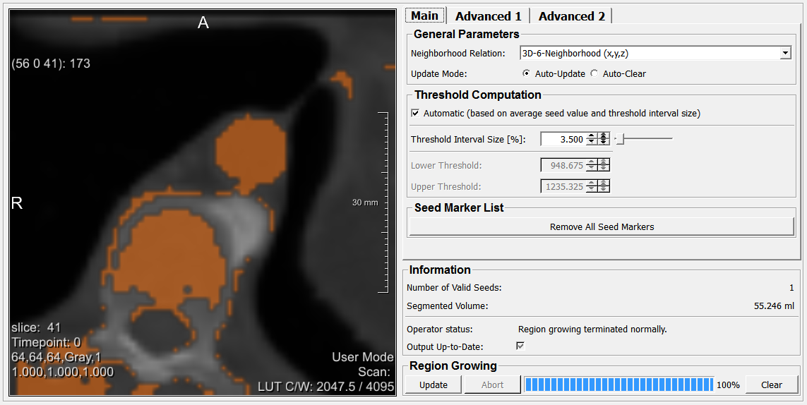 ../../../Modules/Macros/Segmentation/mhelp/Images/Screenshots/RegionGrowingMacro._default.png