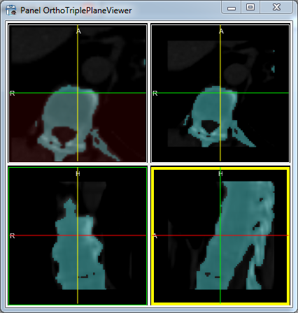 ../../../Modules/Macros/Viewers/TriplePlaneViewer/mhelp/Images/Screenshots/OrthoTriplePlaneViewer.Orthogonalized-Triple-Plane.png