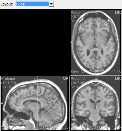 ../../../Modules/Macros/Viewers/mhelp/Images/Screenshots/GVROrthoView2D.Viewer.png