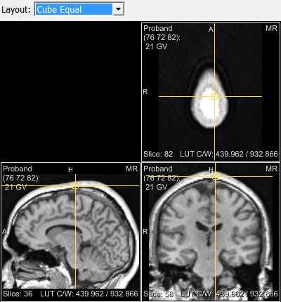 ../../../Modules/Macros/Viewers/mhelp/Images/Screenshots/OrthoView2D.Viewer.png
