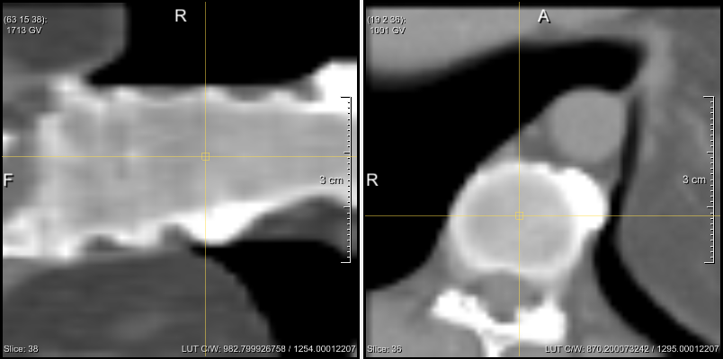 ../../../Modules/Macros/Viewers/mhelp/Images/Screenshots/SynchroView2D.Viewer.png